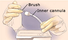 Tracheostomy Tube Brushes